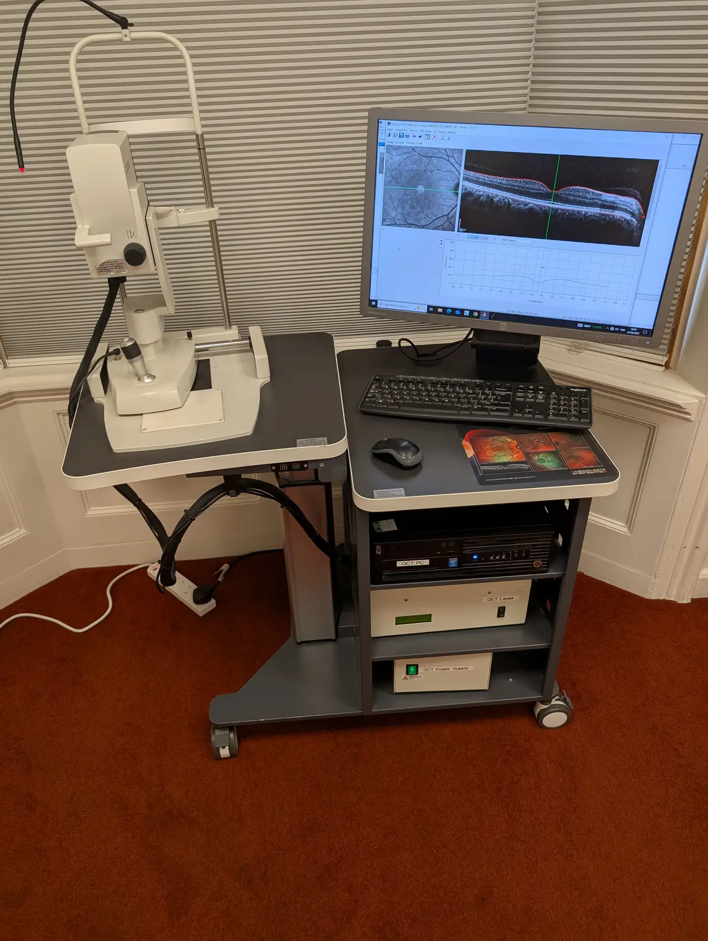 Heidelberg OCT Spectralis