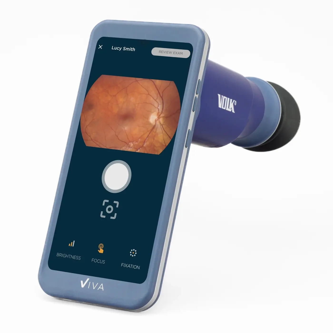 Volk VIVA Non-Myd Hand Held Fundus Camera