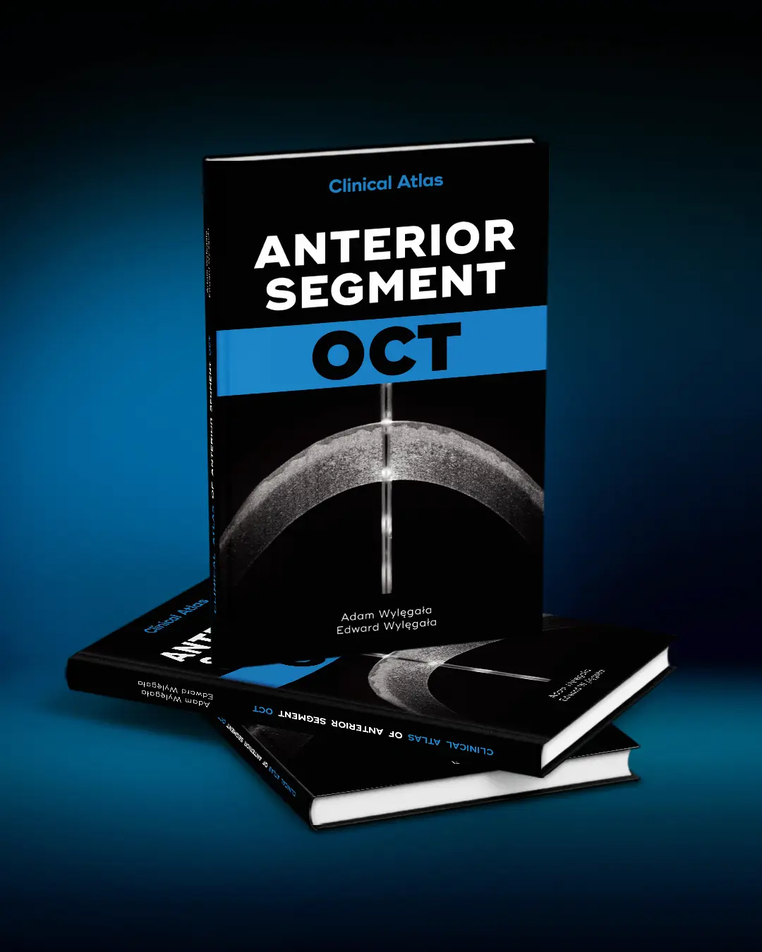 Clinical Atlas of Anterior Segment OCT