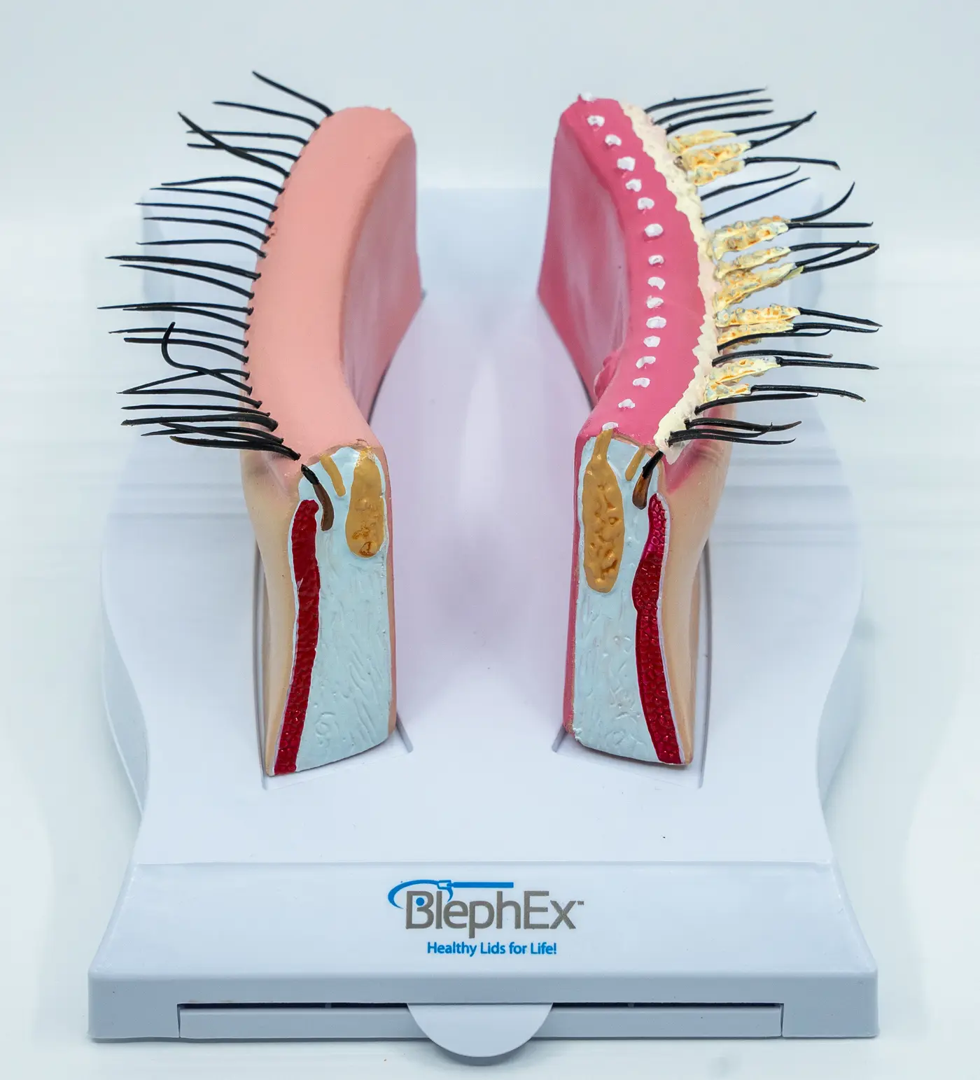 BlephEx® Anatomical Eyelid Model