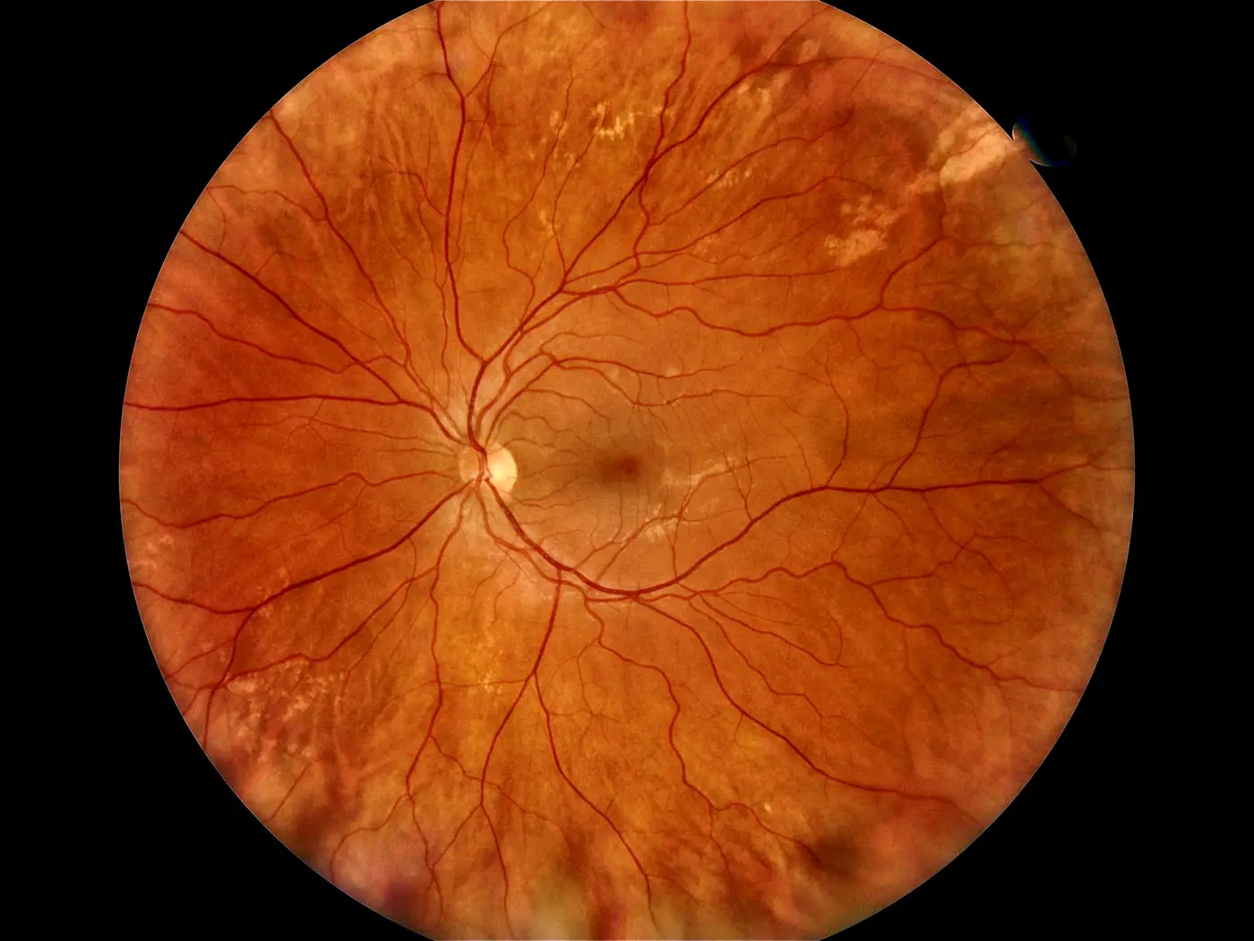 Fundus_Image (170)