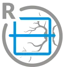 Retina