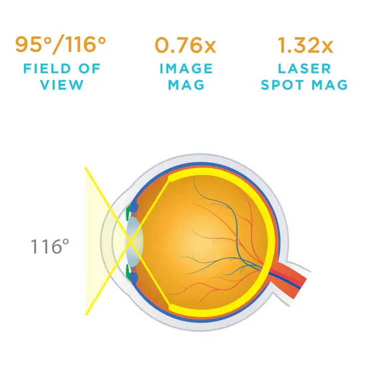 Volk Superfield Lens - Multi Coloured Collection